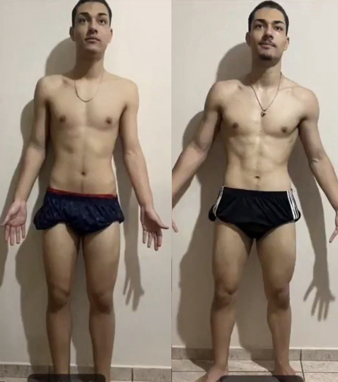 Resultado real de aluna antes e depois